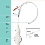 Fibrex® Catheter Patency Medical device design